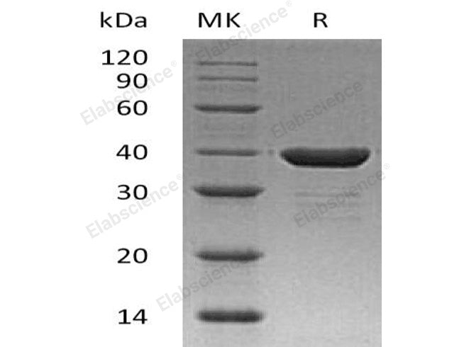 Recombinant Human Carbonic Anhydrase 8/CA8 Protein (His Tag)(Active)