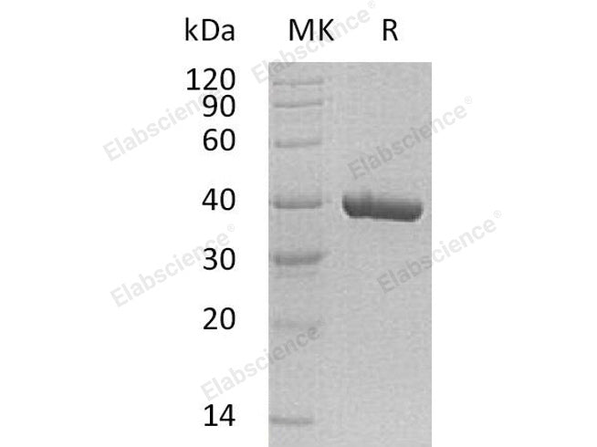 Recombinant Human CA11 Protein (His Tag)
