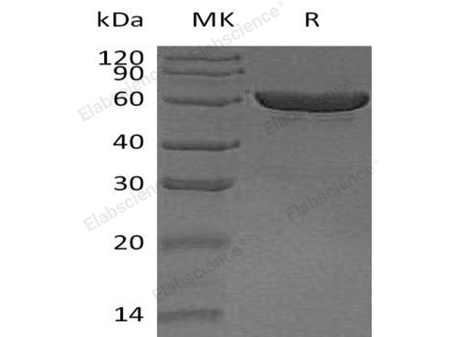 Recombinant Human Carboxylesterase 1/CES1 Protein (His Tag)