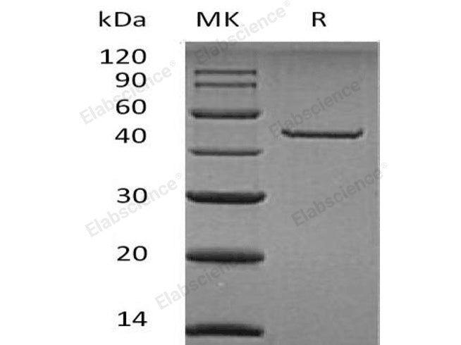 Recombinant Human Carboxypeptidase A2/CPA2 Protein (His Tag)