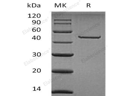 Recombinant Human Carboxypeptidase A2/CPA2 Protein (His Tag)