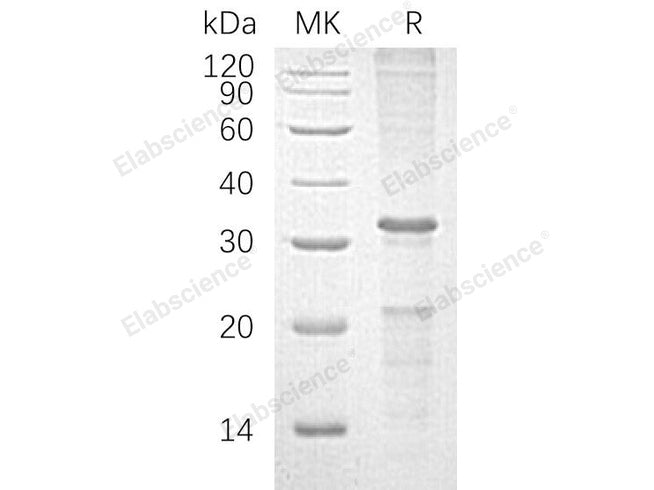 Recombinant Human Caspase-10/CASP10 Protein (His Tag)