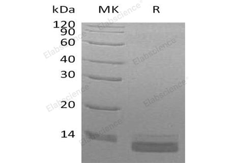 Recombinant Human CCL14/HCC-3 Protein (His Tag)