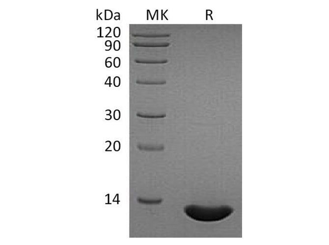 Recombinant Human CCL2/MCP-1 Protein