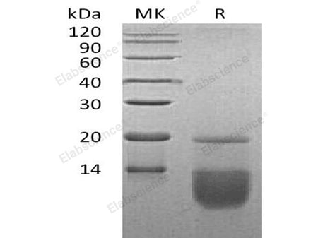 Recombinant Human CCL3 Protein