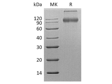 Recombinant Human CD200R1 Protein (Fc Tag)