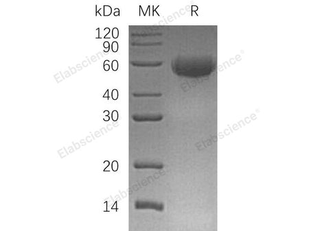 Recombinant Human CD46 Protein (His Tag)