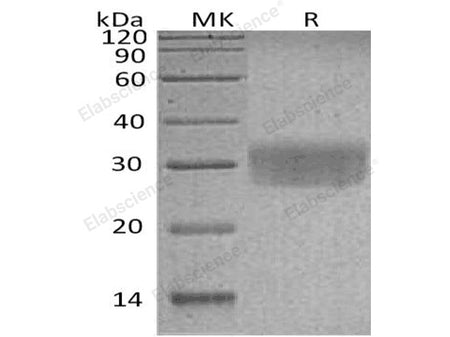 Recombinant Human CD7/GP40 Protein (His Tag)