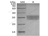 Recombinant Human CD7/GP40 Protein (His Tag)