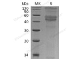 Recombinant Human CD79B/B29 Protein (His Tag)