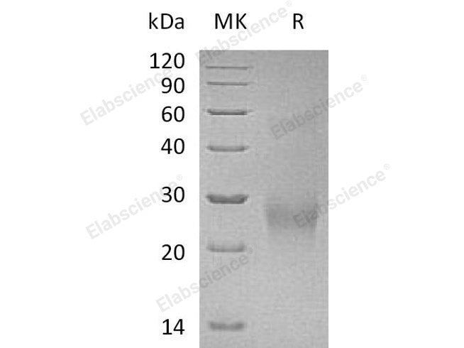 Recombinant Human CDK2AP2 Protein (Human Cells, His Tag)