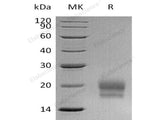 Recombinant Human CEACAM3/CD66d Protein (His Tag)
