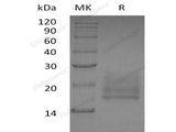 Recombinant Human CEACAM8/CD66b Protein (His Tag)