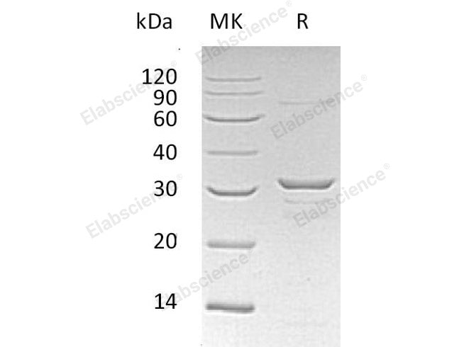 Recombinant Human CLIC1 Protein (His Tag)