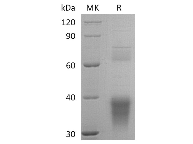 Recombinant Human Clusterin/ApoJ Protein (aa 23-449, His Tag)