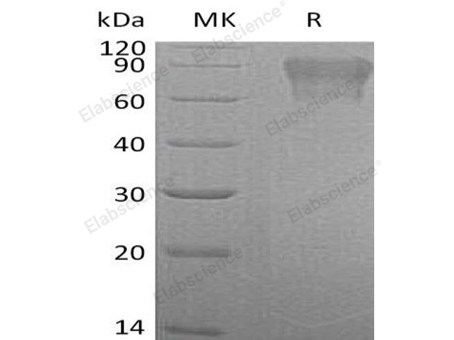 Recombinant Human Coagulation Factor IX/F9 Protein (His Tag)