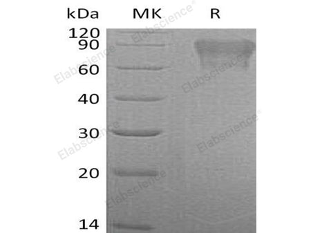 Recombinant Human Coagulation Factor IX/F9 Protein (His Tag)