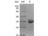 Recombinant Human CCDC134 Protein (His Tag)