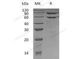 Recombinant Human COL8A1 Protein (His Tag)