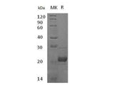 Recombinant Human Complement Component C8 Gamma Chain/C8G Protein (His Tag)