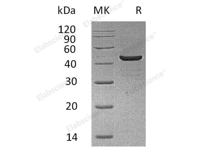 Recombinant Human Creatine Kinase, Muscle/CKM Protein (His Tag)