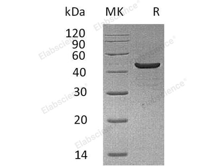 Recombinant Human Creatine Kinase, Muscle/CKM Protein (His Tag)