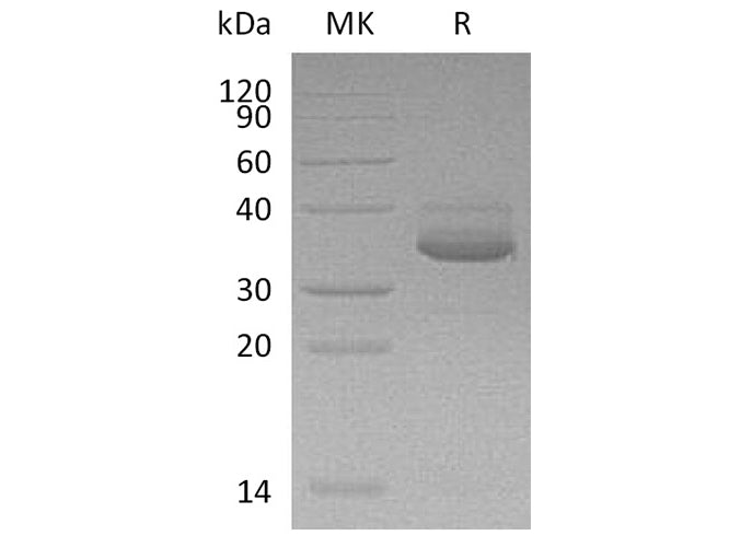 Recombinant Human CXCL10 Protein (Fc & His Tag)
