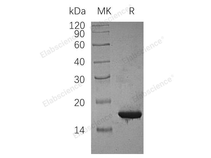 Recombinant Human CDKN2C Protein (His Tag)