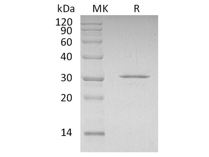 Recombinant Human CDKN1B Protein (His Tag)