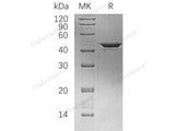 Recombinant Human Cystathionine γ-Lyase/CTH Protein