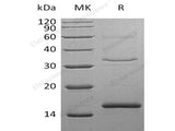 Recombinant Human Cystatin S/CST4 Protein (His Tag)