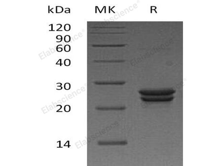 Recombinant Human CDO1 Protein (His Tag)