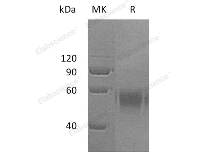 Recombinant Human DR6/TNFRSF21 Protein (Fc Tag)