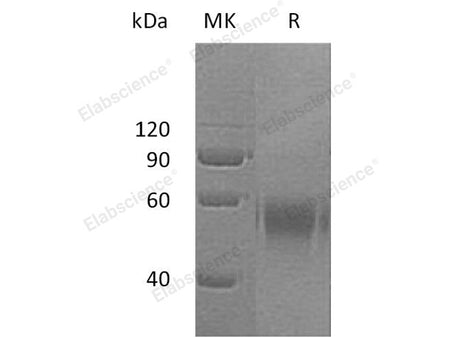 Recombinant Human DR6/TNFRSF21 Protein (Fc Tag)