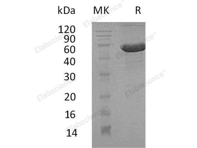 Recombinant Human Dermatopontin/DPT Protein (Fc & His Tag)