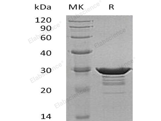 Recombinant Human Desmin Protein (His Tag)