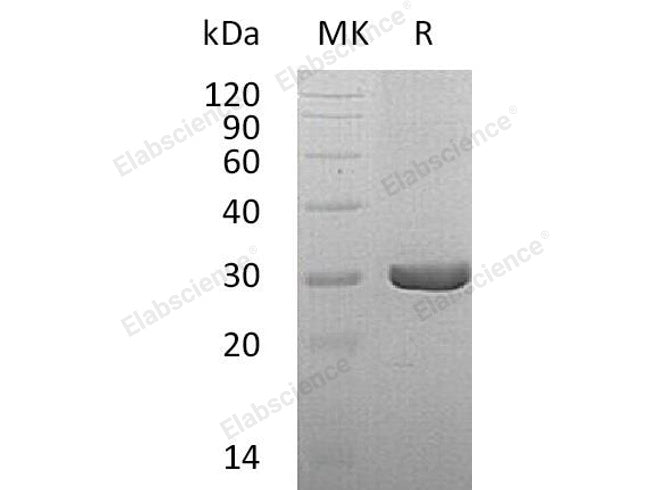 Recombinant Human Dihydropteridine Reductase/QDPR Protein (His Tag) 