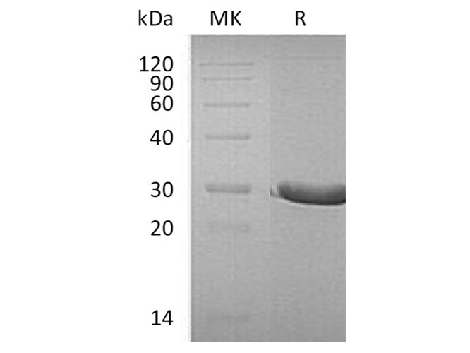 Recombinant Human DTD1 Protein (His Tag)