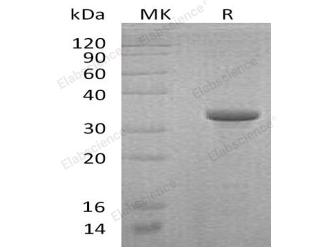 Recombinant Human Endoglin/CD105 Protein (His&Trx Tag)