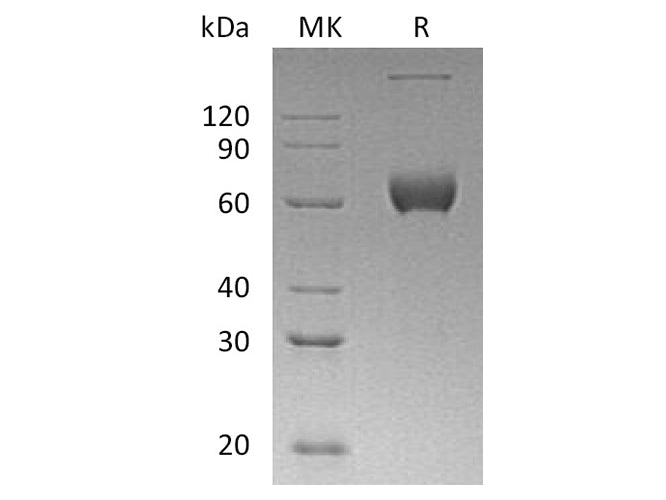 Recombinant Human ESAM Protein (aa 30-247, Fc Tag)
