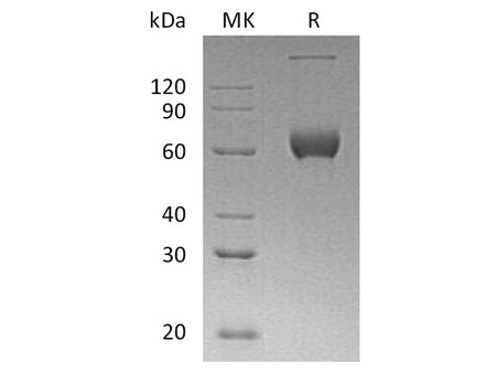 Recombinant Human ESAM Protein (aa 30-247, Fc Tag)