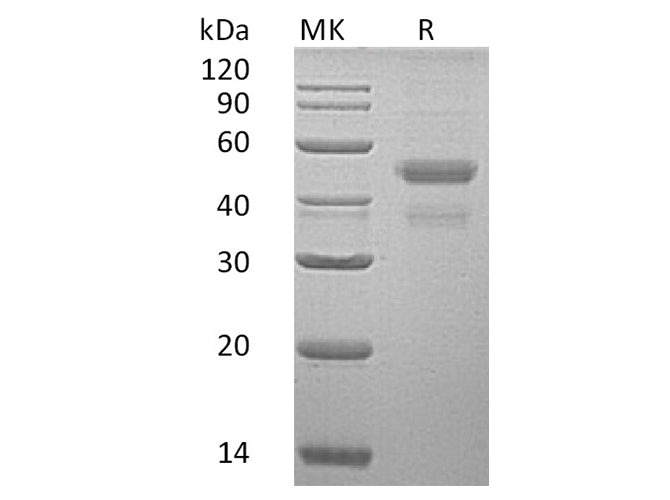 Recombinant Human MAN1B1 Protein (His Tag)