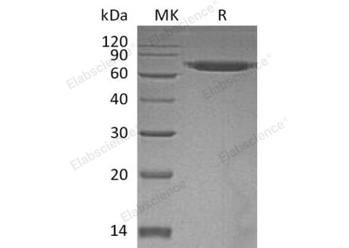 Recombinant Human ERO1A/ERO1L Protein (His Tag)