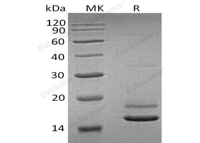 Recombinant Human ERMAP Protein (His Tag)