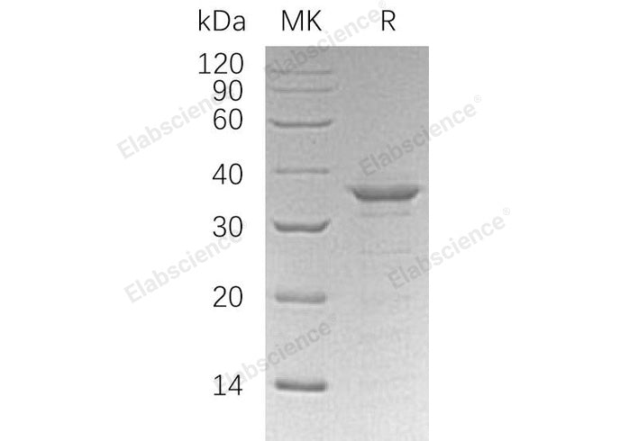 Recombinant Human ETS1/EWSR2 Protein (His Tag)