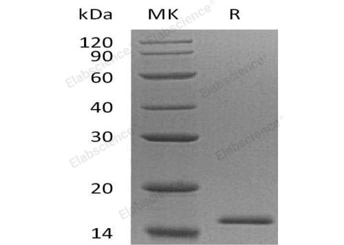 Recombinant Human EIF1B Protein (His Tag)