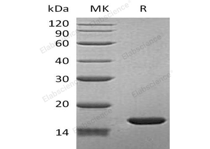Recombinant Human BLBP/FABP7 Protein (His Tag)