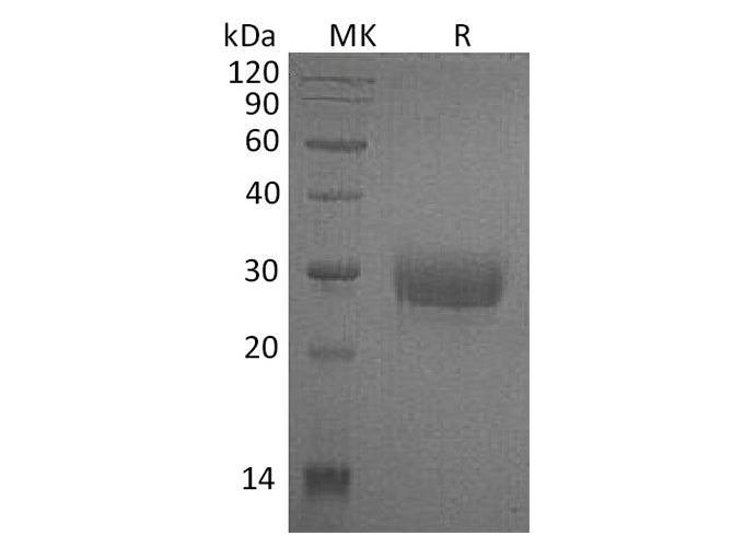 Recombinant Human CD32a/FCGR2A Protein (H131, His Tag)