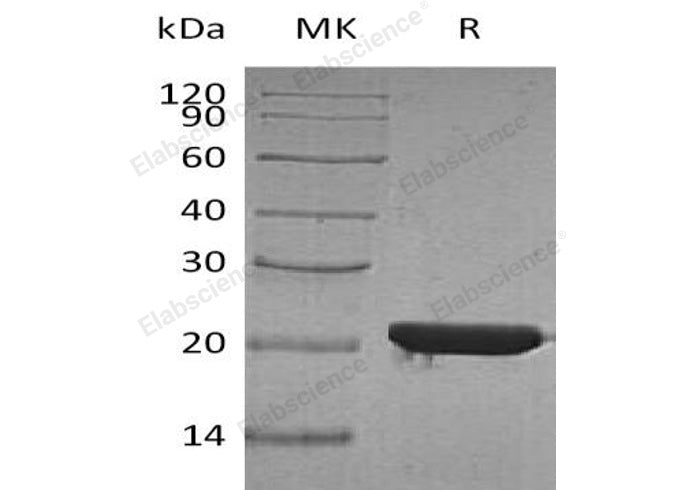 Recombinant Human FTH Protein (His Tag)