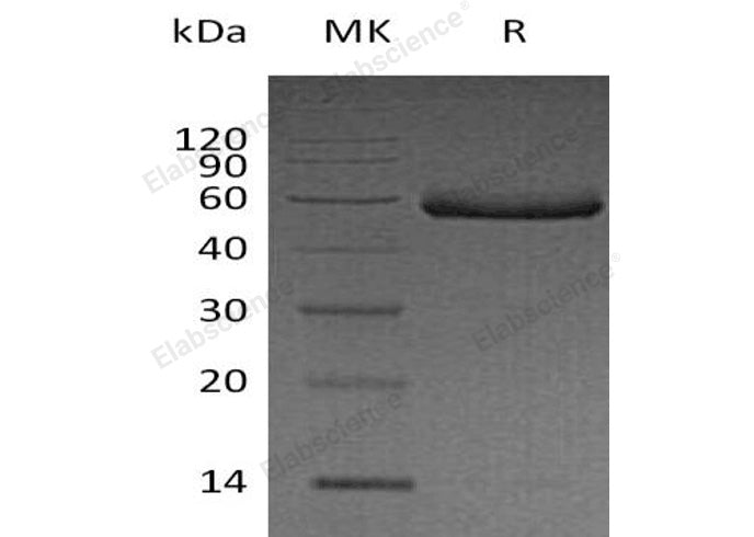 Recombinant Human Fetuin-B/FETUB Protein (His Tag)